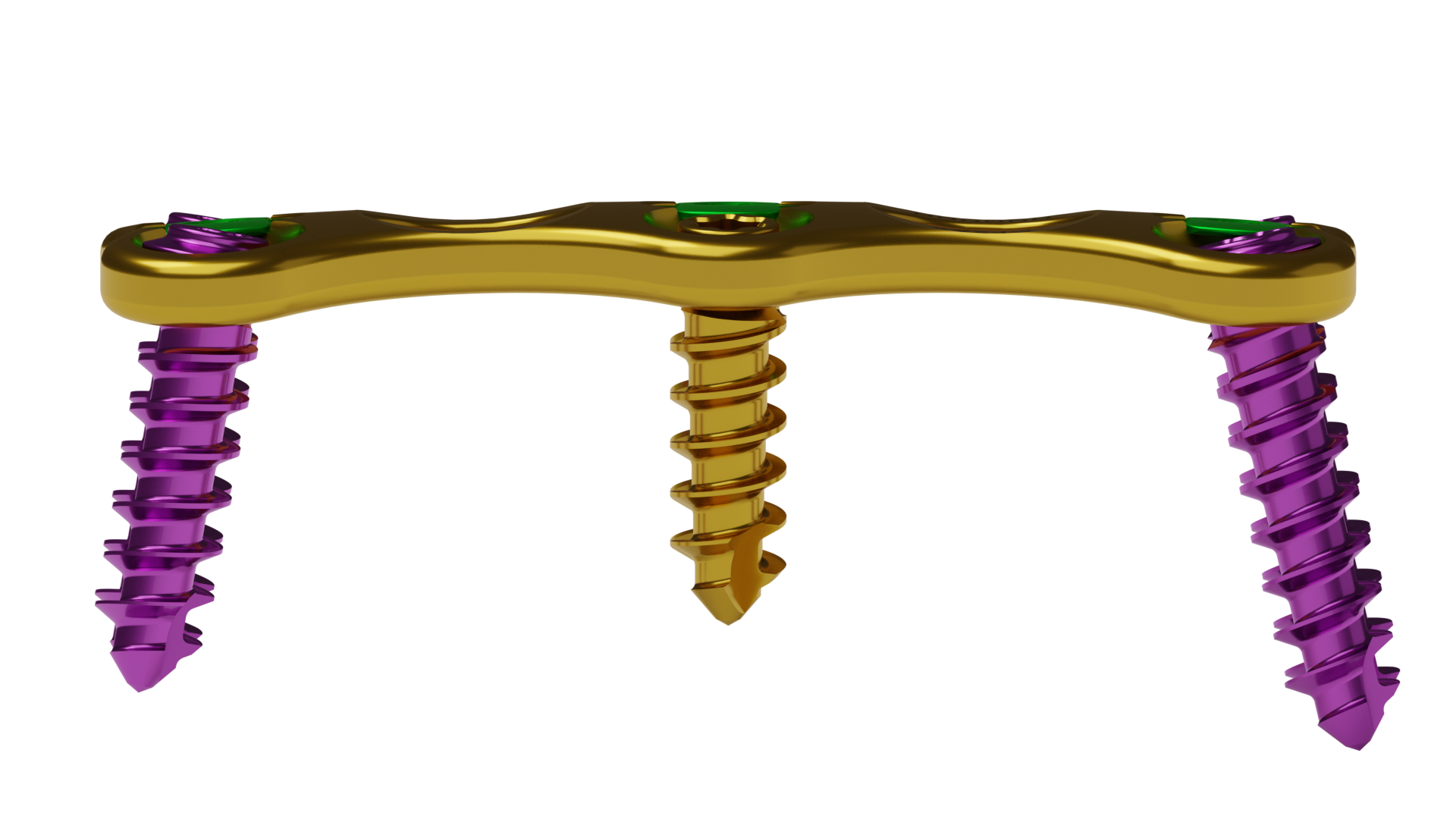Side View of Cervical Plate Cervical plate with narrow body and slender look