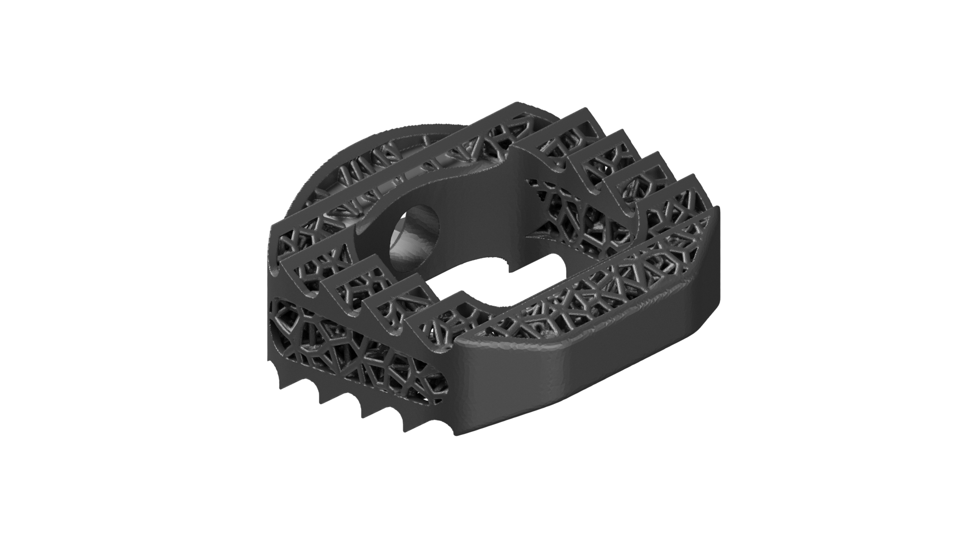 Angled View - 3D Printed Titanium Cervical IBFD latticed, aggressive teeth 3D Printed Titanium Cervical IBFD implant.